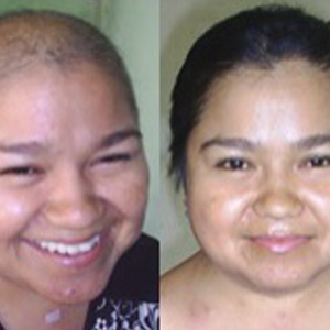 Aparato-Genito-Urinario-InmunoReal-Mexicali-2014