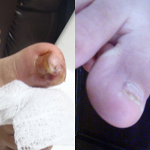 Hongos-InmunoReal-Mexicali-2014